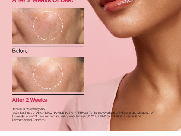 Anua Niacinamide Serum | 30ml
