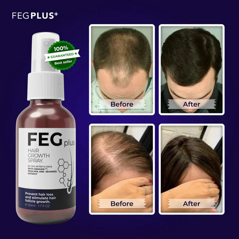 Original FEG Plus Hair Growth Serum