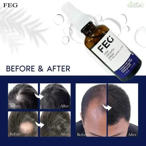 Original FEG Plus Hair Growth Serum
